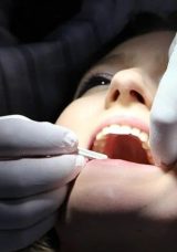 Bilimsel keşif ortaya çıkardı! Tahıl ve şekerler diş çürüklerini artırdı