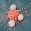 Erkeklerde ve kadınlarda en çok görülen kanser türleri