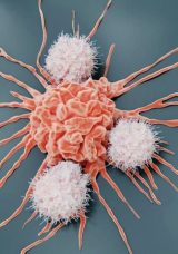 Erkeklerde ve kadınlarda en sık görülen kanser türleri açıklandı