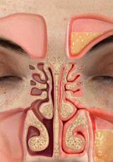 Şişen burun etlerini küçültüyor; Günde 1 bardak kafi…