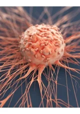 Kalın bağırsak kanseri “geliyorum” diyor