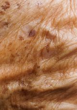 Günde 1 kez sürün, yaşlılık lekelerini götürün…