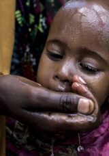 Afrika, 25 yılın en kötü kolera salgınıyla karşı karşıya