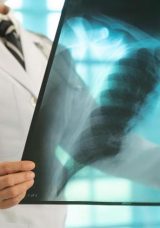 Erken tanı hayati önem taşıyor! Akciğer kanserinin belirtileri ne?